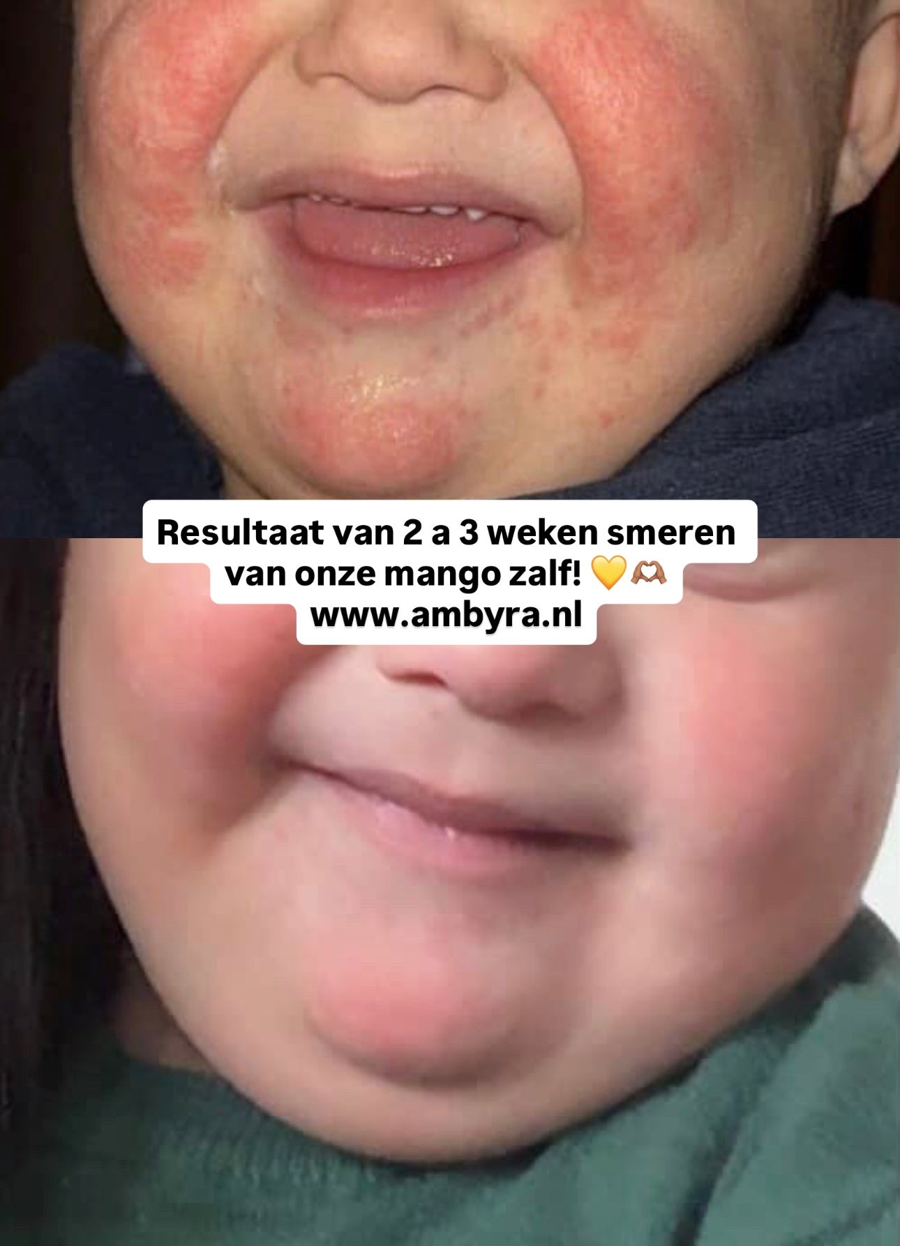 WEER OP VOORRAAD | Mango zalf 15ml